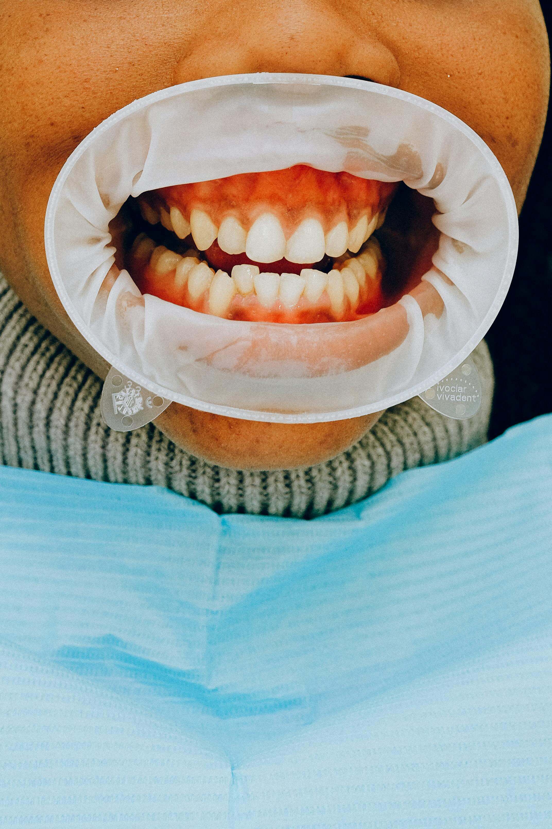 tratamente dentare